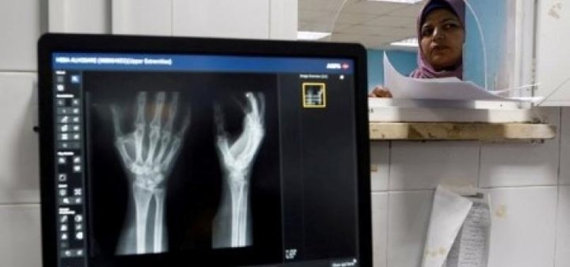 GAZA: ISRAEL NOT ALLOWING IN ENOUGH X-RAY MACHINES FOR MEDICAL CARE