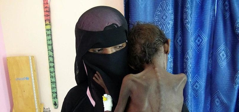 UN: NEARLY 400,000 CHILDREN FACING STARVATION IN WAR-TORN YEMEN