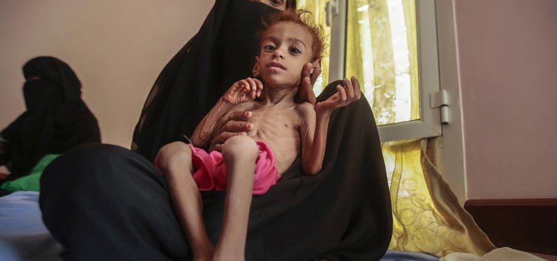 THOUSANDS TRAPPED IN CROSSFIRE IN NORTHERN YEMEN, UN SAYS