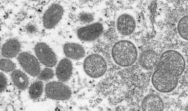 Pakistan reports 3rd case of monkeypox