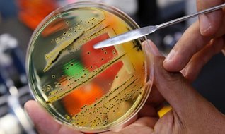Akıllı bakteriye 1 TL’lik yatırım