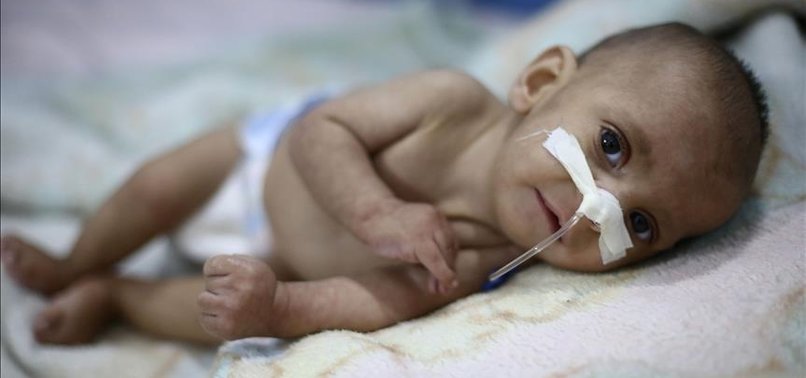 BABY SUCCUMBS TO MALNUTRITION IN SYRIAS EASTERN GHOUTA