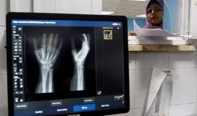 Gaza: Israel not allowing in enough X-ray machines for medical care
