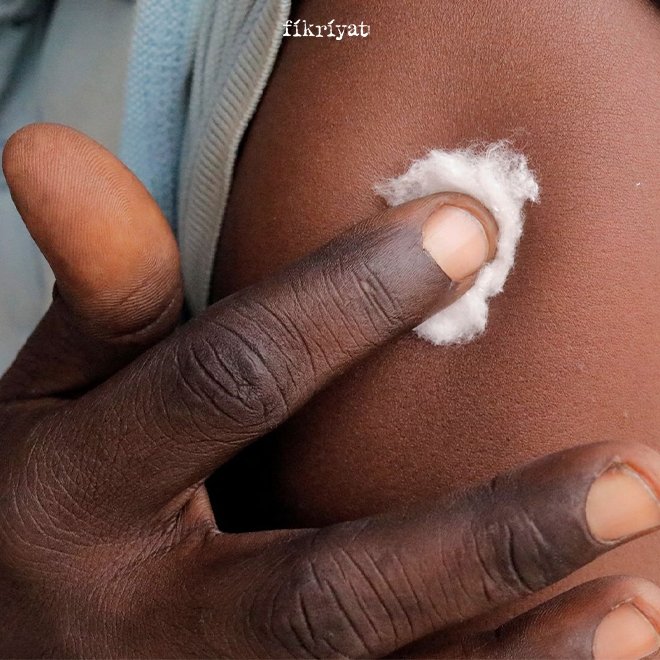 Maymun çiçeği virüsü aşısı