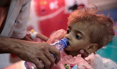WHO provides aid to fight child malnutrition in Yemen