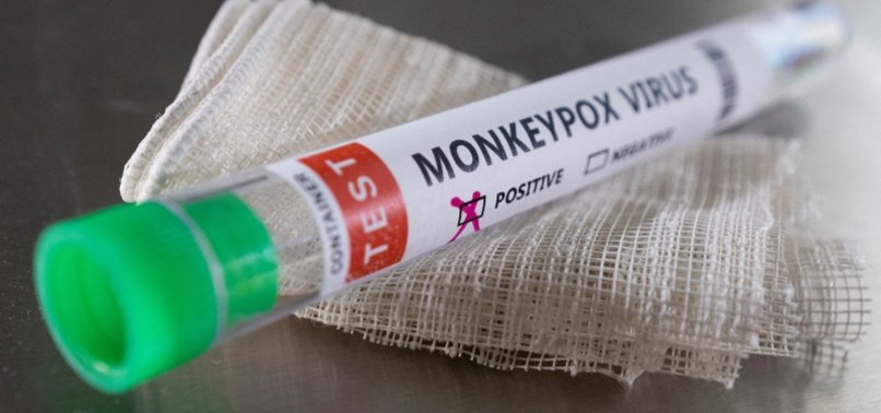WHAT WE KNOW OF THE SYMPTOMS AND SPREAD OF MONKEYPOX