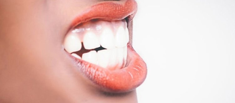 Çocukluk travması kişilerin sebepsiz yere diş sıkmasına neden olabiliyor