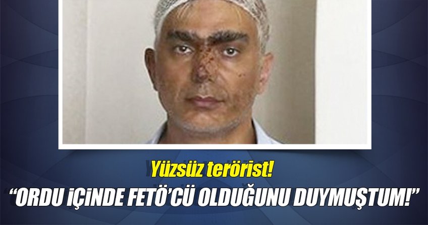 Yüzsüz Terörist!