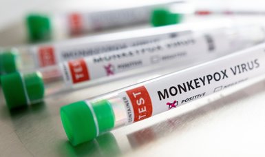 Belgium imposes 3-week quarantine on monkeypox patients