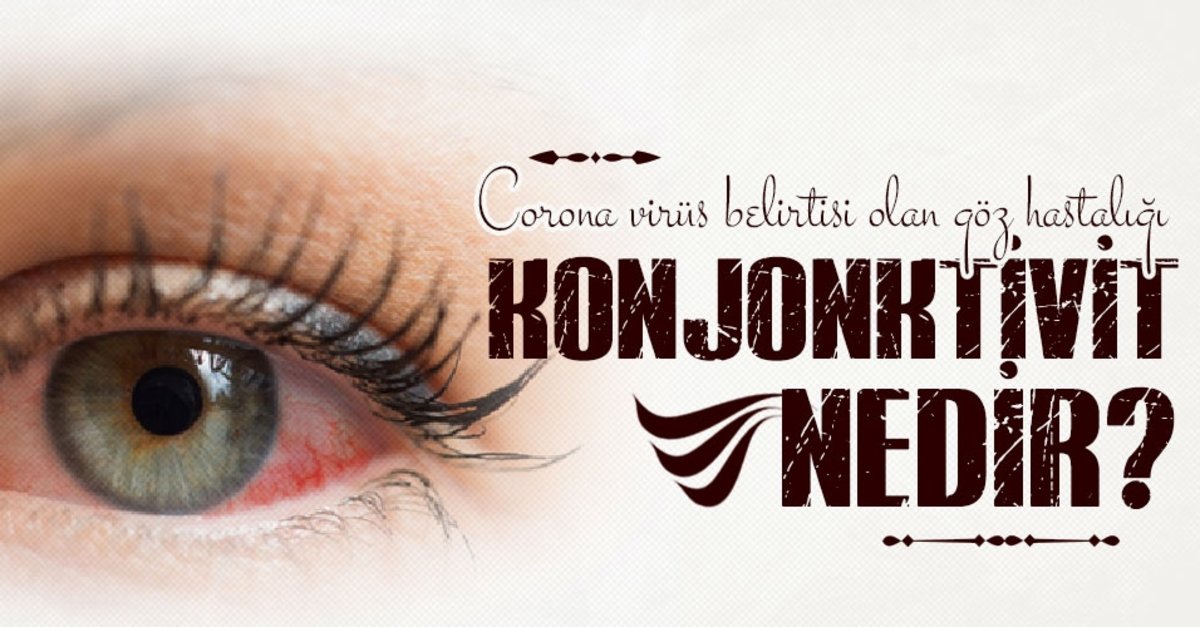 Corona Virus Belirtisi Olan Goz Hastaligi Konjonktivit Konjonktivit Ne Demek Fikriyat Corona Virus Belirtisi Olan Goz Hastaligi Konjonktivit Konjonktivit Ne Demek Fikriyat